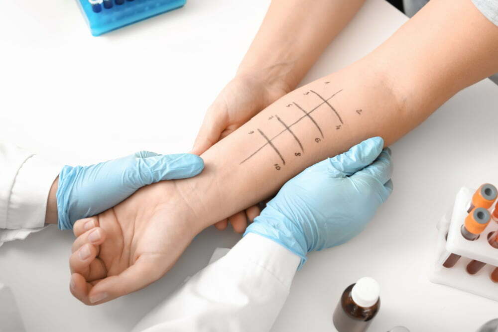Skin Prick Test (SPT) & Immunotherapy